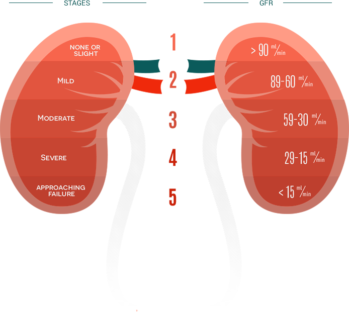 Kidney Disease Stages Chart Labb By AG